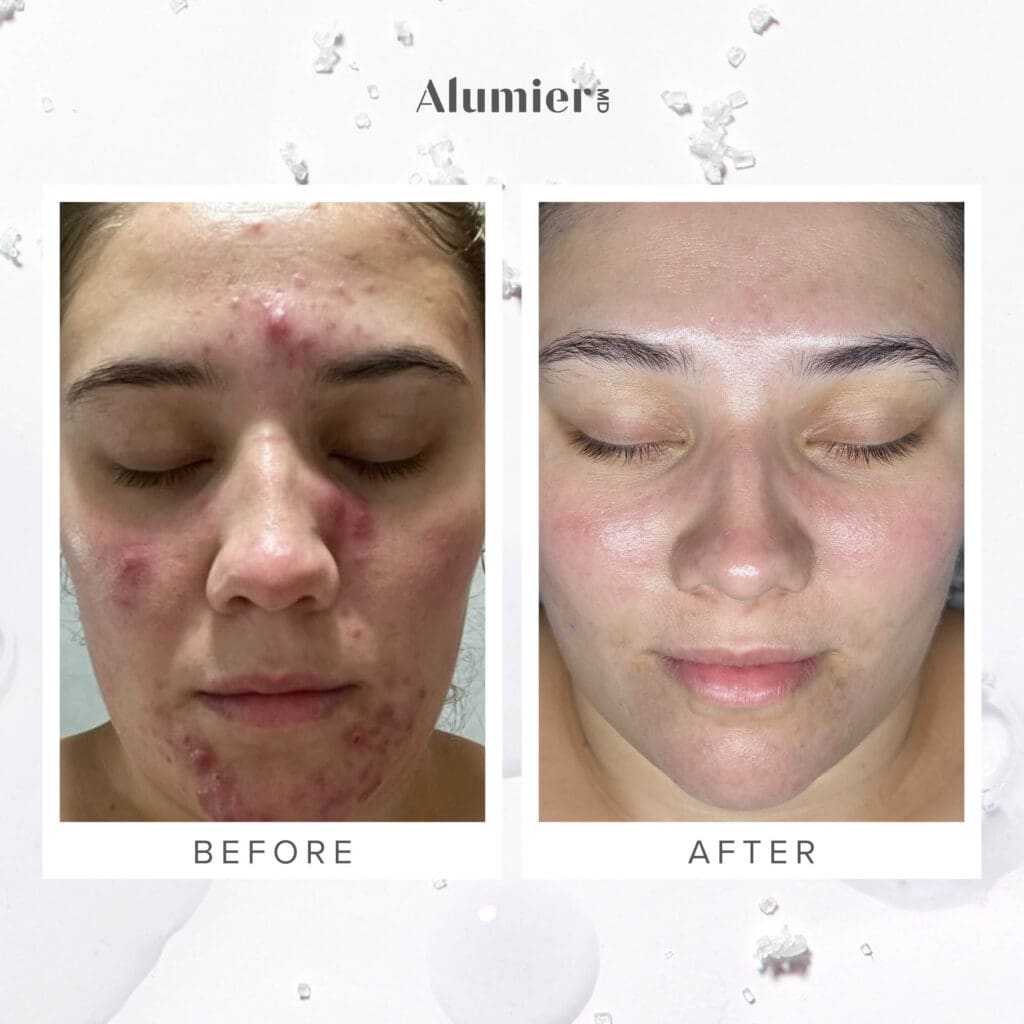 AlumierMD-IG-1080-8